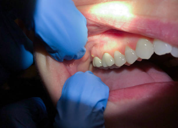 Emergency Dentist Open Today in MI